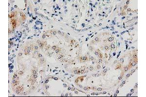 Immunohistochemical staining of paraffin-embedded Human Kidney tissue using anti-ILVBL mouse monoclonal antibody. (ILVBL 抗体)