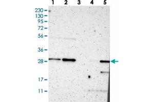 Western blot analysis of Lane 1: RT-4, Lane 2: U-251 MG, Lane 3: Human Plasma, Lane 4: Liver, Lane 5: Tonsil with TSPAN13 polyclonal antibody . (TSPAN13 抗体)