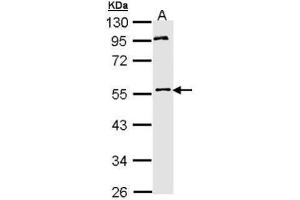 WB Image Sample (30 ug of whole cell lysate) A: Hep G2 , 10% SDS PAGE antibody diluted at 1:1000 (MPP1 抗体  (Center))