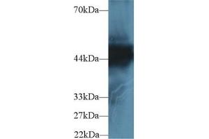 Detection of CK18 in Human Hela cell lysate using Polyclonal Antibody to Cytokeratin 18 (CK18) (Cytokeratin 18 抗体  (AA 238-396))