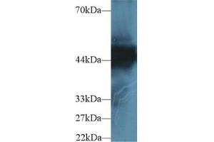Detection of CK18 in Human Hela cell lysate using Polyclonal Antibody to Cytokeratin 18 (CK18) (Cytokeratin 18 抗体  (AA 238-396))