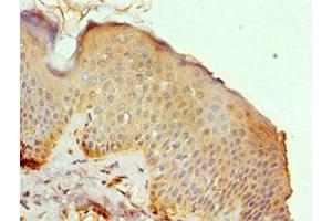 Immunohistochemistry of paraffin-embedded human skin tissue using ABIN7150623 at dilution of 1:100 (Mre11 抗体  (AA 1-205))