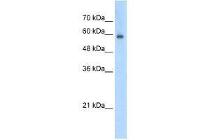 WB Suggested Anti-EIF4G3 Antibody Titration:  0. (EIF4G3 抗体  (N-Term))