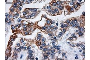 Image no. 1 for anti-Keratin 18 (KRT18) (AA 69-372) antibody (ABIN1491637) (Cytokeratin 18 抗体  (AA 69-372))