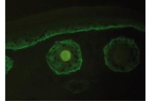 Immunofluorescence image of Collagen type XVII staining in cryosection of murine Skin. (COL17 抗体)