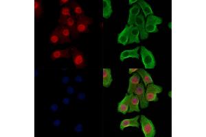 Phospho-ZEB2 (Ser784) Antibody staining Hela cells(heat shock treatment) by IF/ICC. (ZEB2 抗体  (pSer784))