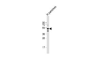 Anti-GIPR Antibody (Center) at 1:1000 dilution + human pancreas lysate Lysates/proteins at 20 μg per lane. (GIPR 抗体  (AA 104-136))