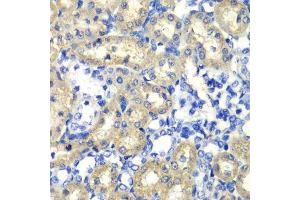 Immunohistochemistry of paraffin-embedded rat kidney using ABAT antibody. (ABAT 抗体  (AA 29-300))