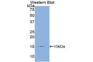 Western Blotting (WB) image for anti-Cystatin B (Stefin B) (CSTB) (AA 1-98) antibody (ABIN1077970) (CSTB 抗体  (AA 1-98))