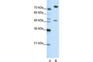 Western Blotting (WB) image for anti-Sjogren Syndrome Antigen B (SSB) antibody (ABIN2462144) (SSB 抗体)