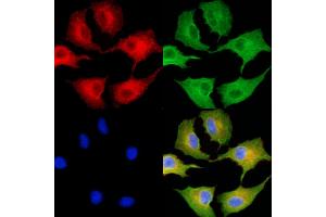 ABIN6265124 and ABIN6279850 staining  cells by IF/ICC.