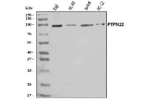 Western blot analysis of PTPN22 using anti-PTPN22 antibody (ABIN7599374).