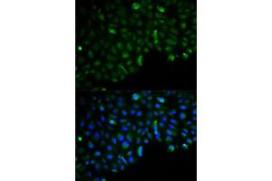 Immunofluorescence analysis of U2OS cells using HK2 antibody. (Hexokinase 2 抗体  (AA 1-120))