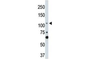 LATS2 antibody used in western blot to detect LATS2 in NIH3T3 cell lysate (LATS2 抗体  (AA 228-258))