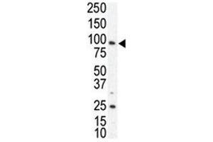 Western Blotting (WB) image for anti-AXL Receptor tyrosine Kinase (AXL) (AA 13-44) antibody (ABIN3030091)