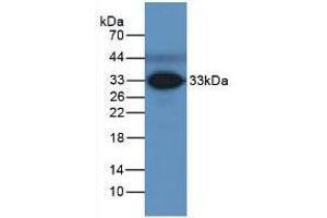 Western blot analysis of Human Serum. (FCN3 抗体  (AA 34-297))