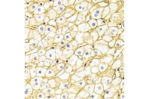 Immunohistochemistry (IHC) image for anti-Basigin (Ok Blood Group) (BSG) (AA 30-200) antibody (ABIN1512647)
