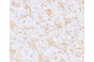 Immunohistochemistry (IHC) image for anti-Cytoskeletal Actin (CIMG_00972) (AA 1-50) antibody (ABIN7449436) (Recombinant Cytoskeletal Actin (CIMG_00972) (AA 1-50) 抗体)