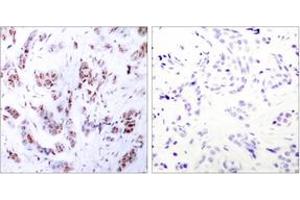 Immunohistochemistry (IHC) image for anti-Myocyte Enhancer Factor 2A (MEF2A) (AA 279-328) antibody (ABIN2889024) (MEF2A 抗体  (AA 279-328))