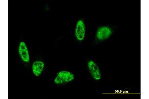 Immunofluorescence of monoclonal antibody to ALPK3 on HeLa cell. (ALPK3 抗体  (AA 1811-1906))