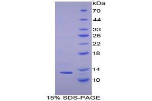 SDS-PAGE analysis of Human Cystatin A Protein. (CSTA 蛋白)