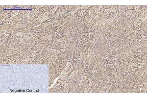 anti-Claudin 5 (CLDN5) (AA 140-220) antibody