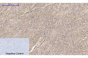 Immunohistochemical analysis of paraffin-embedded human uterus tissue. (Claudin 5 抗体  (AA 140-220))
