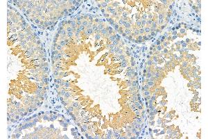 ABIN6259253 and ABIN6275428 at 1/100 staining Rat testis tissue by IHC-P. (PDXDC1 抗体  (C-Term))
