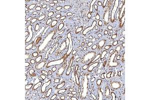 IHC analysis of TRMT61A using anti-TRMT61A antibody (ABIN7599220).