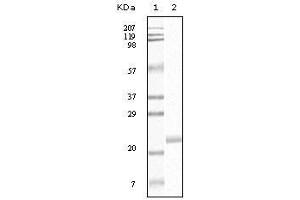 Western Blot showing EphB4 antibody used against truncated EphB4 recombinant protein. (EPH Receptor B4 抗体)