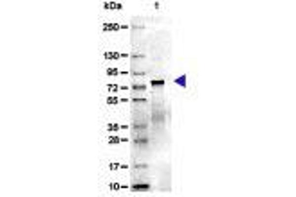 Transferrin Protein (TF)