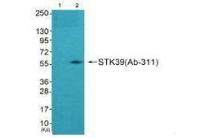 Western blot analysis of extracts from A549 cells using STK39 (Ab-311) antibody,The lane on the left is treated with synthesized peptide. (STK39 抗体  (Ser311))