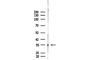 Western blot analysis of lysates from F10-LUC cells(LPS, 4h treatment), using OR2L2 Antibody at 1/1000 dilution.