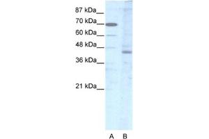 Western Blotting (WB) image for anti-LIM Homeobox 2 (LHX2) antibody (ABIN2463841) (LHX2 抗体)