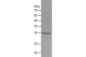 Western Blotting (WB) image for Fibroblast Growth Factor 9 (FGF-9) (AA 4-208) protein (His tag) (ABIN7122950)