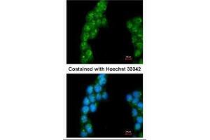 ICC/IF Image Immunofluorescence analysis of methanol-fixed A431, using Proteasome 26S S3, antibody at 1:200 dilution. (Proteasome 26S S3 (Center) 抗体)