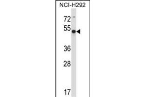 ACTR6 Antibody (C-term) (ABIN657810 and ABIN2846778) western blot analysis in NCI- cell line lysates (35 μg/lane). (ACTR6 抗体  (C-Term))