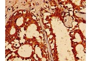 Immunohistochemistry (IHC) image for anti-Transcription Factor AP-2 gamma (Activating Enhancer Binding Protein 2 Gamma) (TFAP2C) (AA 8-180) antibody (ABIN7172475)