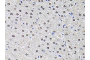 Immunohistochemistry of paraffin-embedded rat liver using HUS1 antibody (ABIN6131776, ABIN6142084, ABIN6142086 and ABIN6218116) at dilution of 1:100 (40x lens). (HUS1 抗体  (AA 1-280))