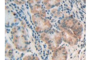 DAB staining on IHC-P; Samples: Human Stomach Tissue (NG2 抗体  (AA 1705-1942))
