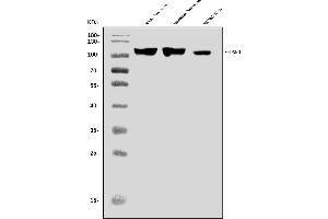 Western blot analysis of Dynamin 3/DNM3 using anti-Dynamin 3/DNM3 antibody (ABIN7601163).