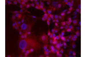 Immunofluorescence (IF) image for anti-Integrin beta 3 (ITGB3) antibody (Alexa Fluor 647) (ABIN2657832) (Integrin beta 3 抗体  (Alexa Fluor 647))