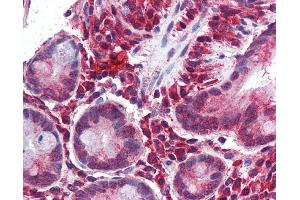 Immunohistochemistry (IHC) image for anti-Matrix Gla Protein (MGP) (Middle Region) antibody (ABIN406168) (MGP 抗体  (Middle Region))