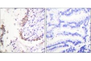 Immunohistochemistry (IHC) image for anti-Solute Carrier Family 22 (Organic Anion Transporter), Member 8 (SLC22A8) (AA 191-240) antibody (ABIN1533363)