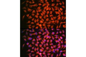 Immunofluorescence analysis of HeLa using RARβ Rabbit mAb (ABIN7269947) at dilution of 1:100 (40x lens). (Retinoic Acid Receptor beta 抗体)
