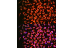 Immunofluorescence analysis of HeLa using RARβ Rabbit mAb (ABIN7269947) at dilution of 1:100 (40x lens).