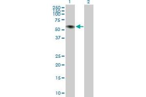Western Blot analysis of ILDR1 expression in transfected 293T cell line ( H00286676-T02 ) by ILDR1 MaxPab polyclonal antibody. (ILDR1 抗体  (AA 1-502))