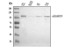 Western blot analysis of ADAM19 using anti-ADAM19 antibody (ABIN3044069).
