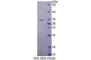 SDS-PAGE (SDS) image for Ubiquitin Specific Peptidase 1 (USP1) (AA 1-198) protein (His tag) (ABIN6238851)