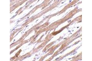 Immunohistochemistry of TIRAP in human heart tissue with this product at 20 μg/ml. (TIRAP 抗体  (Center))